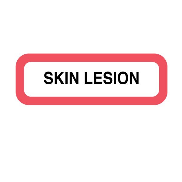 Nevs Position Labels - Skin Lesion 1/2" x 1-1/2" White w/Red & Black XP-639 - main